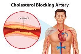kolesteron nasıl düşer